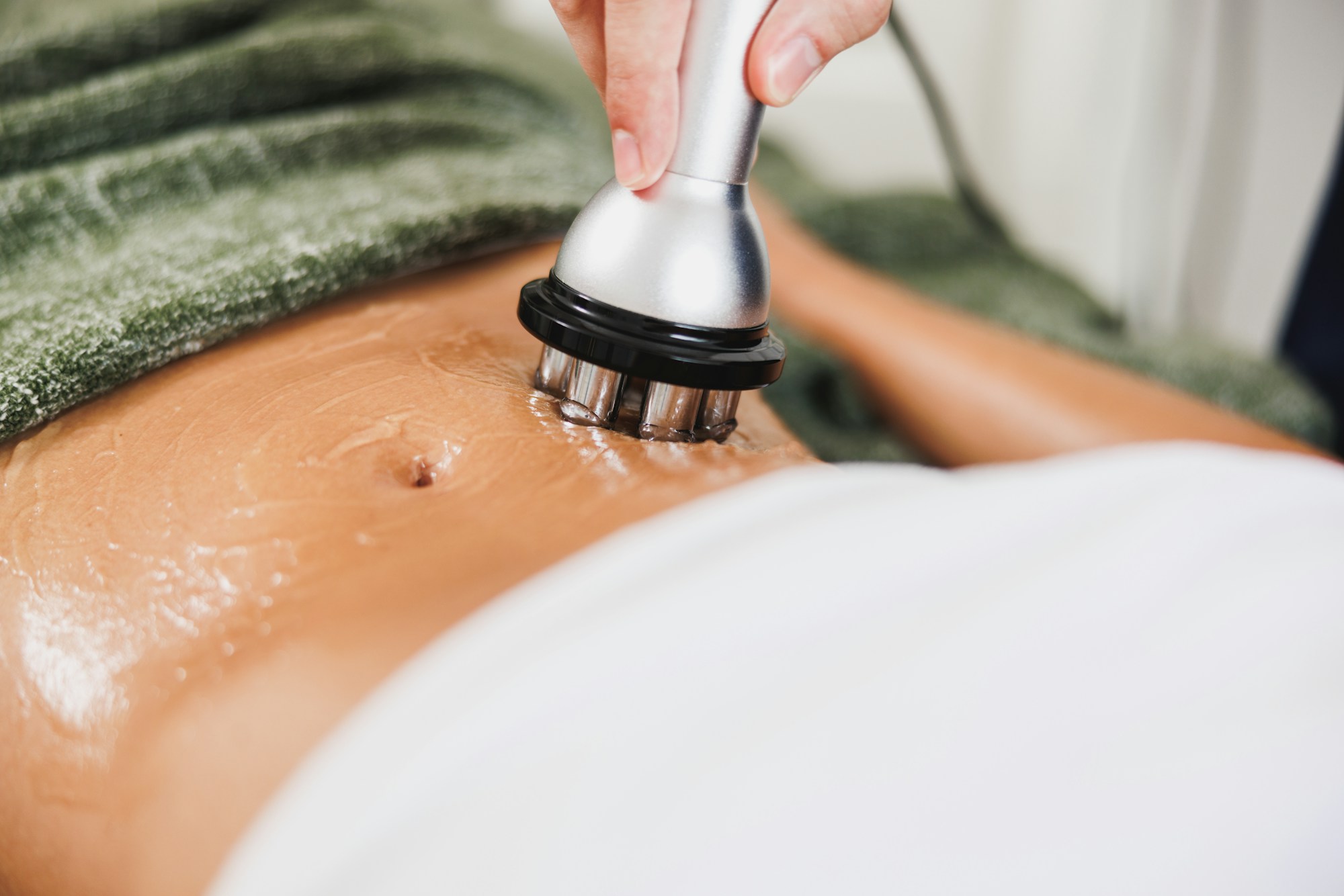 RF lifting – radiofrekvence